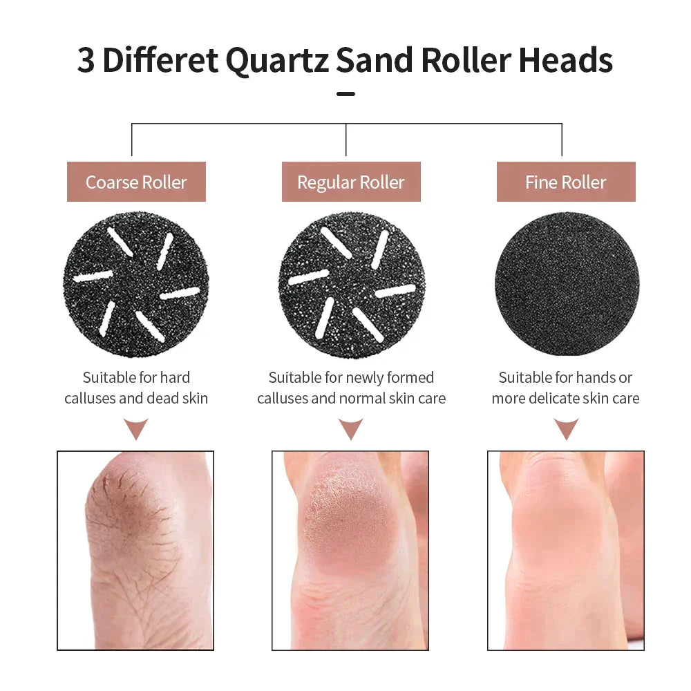 Electric Foot Callus Remover