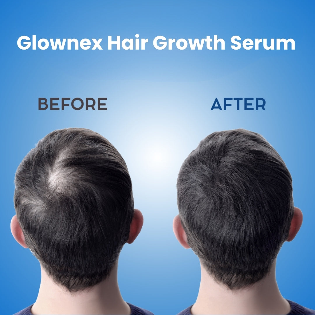 Glownex Hair Growth Serum